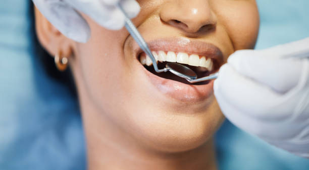 Best Emergency Dental Care for Broken or Chipped Teeth in Litchfield Beach, SC